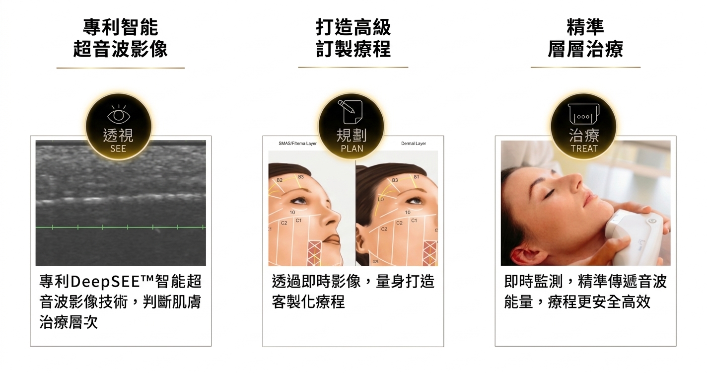 Ultherapy PRIME 美國音波二代 極透+ 獨家黃金波準原理