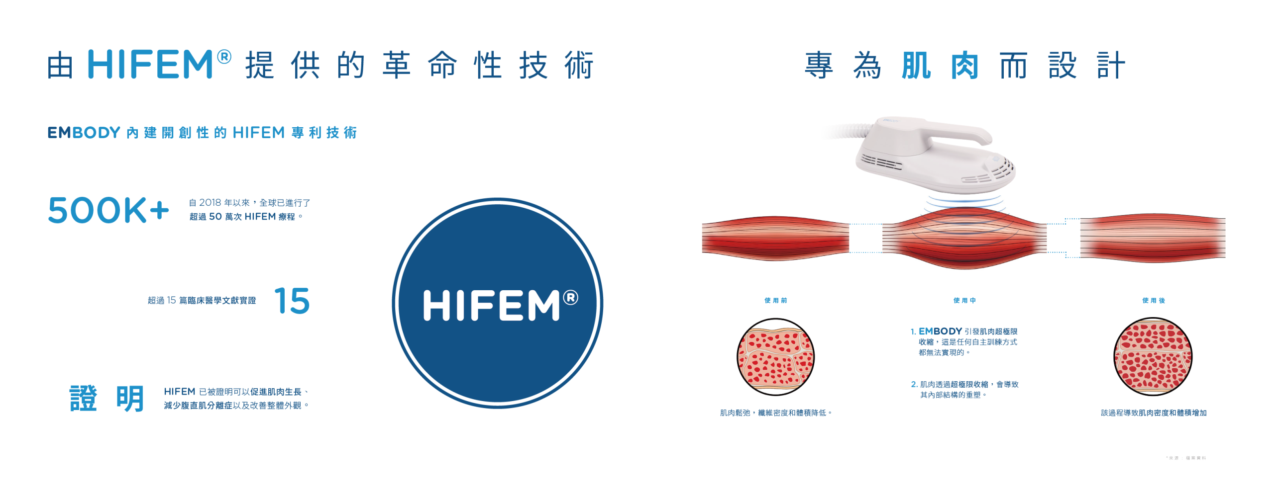 "EMBODY® 核心美力 HIFEM專利電磁技術深層刺激肌肉